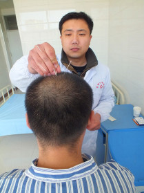 针灸治疗.jpg